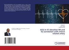 Copertina di ECG in ST elevation MI and its correlation with infarct related artery