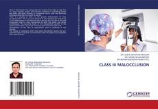 Copertina di CLASS III MALOCCLUSION