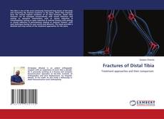 Capa do livro de Fractures of Distal Tibia 