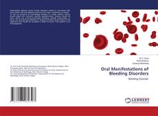 Couverture de Oral Manifestations of Bleeding Disorders