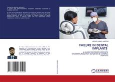 Capa do livro de FAILURE IN DENTAL IMPLANTS 