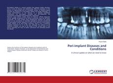 Buchcover von Peri-implant Diseases and Conditions