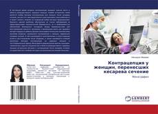 Capa do livro de Контрацепция у женщин, перенесших кесарева сечение 