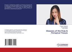 Couverture de Diseases of the Pulp & Periapical Tissues