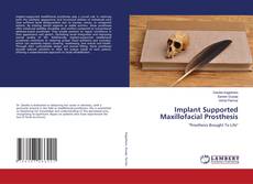 Copertina di Implant Supported Maxillofacial Prosthesis