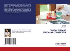 Buchcover von DENTAL IMPLANT ABUTMENT CONNECTION