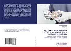 Bookcover of Soft tissue augmentation procedures around teeth and dental implants