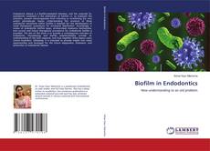 Couverture de Biofilm in Endodontics