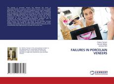 Buchcover von FAILURES IN PORCELAIN VENEERS
