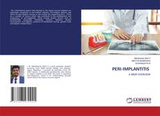 Copertina di PERI-IMPLANTITIS