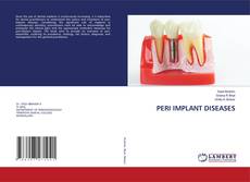 Couverture de PERI IMPLANT DISEASES