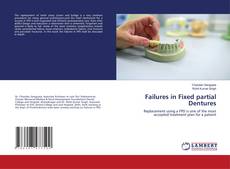Failures in Fixed partial Dentures kitap kapağı