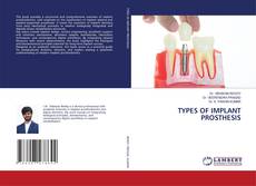 Copertina di TYPES OF IMPLANT PROSTHESIS