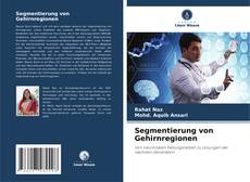 Portada del libro de Segmentierung von Gehirnregionen