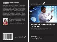 Bookcover of Segmentación de regiones cerebrales