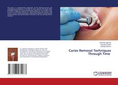 Bookcover of Caries Removal Techniques Through Time