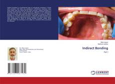 Bookcover of Indirect Bonding