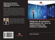 Bookcover of Médecine de précision : Applications de l'IA à la segmentation des tumeurs cérébrales