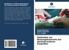 Bookcover of Methoden zur Blutungskontrolle bei dentoalveolären Eingriffen