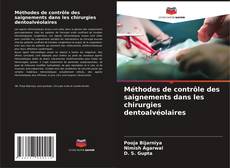 Bookcover of Méthodes de contrôle des saignements dans les chirurgies dentoalvéolaires