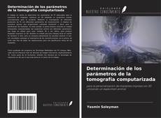 Bookcover of Determinación de los parámetros de la tomografía computarizada