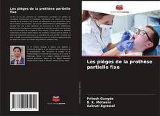 Buchcover von Les pièges de la prothèse partielle fixe