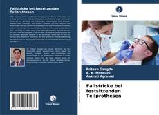 Bookcover of Fallstricke bei festsitzenden Teilprothesen