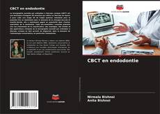 Buchcover von CBCT en endodontie