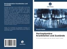 Bookcover of Periimplantäre Krankheiten und Zustände