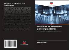 Maladies et affections péri-implantaires kitap kapağı