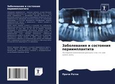 Bookcover of Заболевания и состояния периимплантита