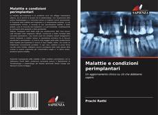 Buchcover von Malattie e condizioni perimplantari