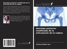 Bookcover of Abordaje posterior modificado de la articulación de la cadera