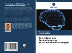 Capa do livro de Bewertung und Behandlung von Subarachnoidalblutungen 