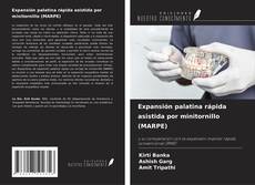 Capa do livro de Expansión palatina rápida asistida por minitornillo (MARPE) 