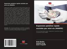 Buchcover von Expansion palatine rapide assistée par mini-vis (MARPE)