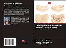 Bookcover of Conception de prothèses partielles amovibles