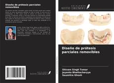Bookcover of Diseño de prótesis parciales removibles