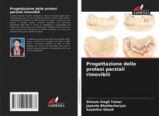 Bookcover of Progettazione delle protesi parziali rimovibili