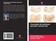 Bookcover of Conceção de próteses parciais removíveis