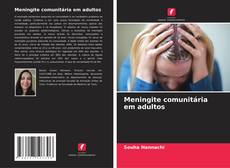 Buchcover von Meningite comunitária em adultos