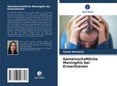 Bookcover of Gemeinschaftliche Meningitis bei Erwachsenen