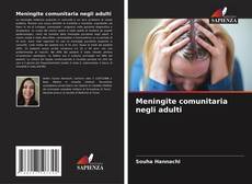 Buchcover von Meningite comunitaria negli adulti