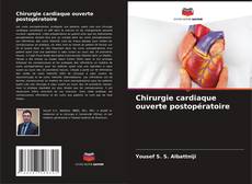 Buchcover von Chirurgie cardiaque ouverte postopératoire