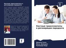 Buchcover von Костные трансплантаты в регенерации пародонта