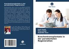 Capa do livro de Knochentransplantate in der parodontalen Regeneration 