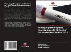 Buchcover von Biologie pathologique moléculaire de l'infection à coronavirus SARS-CoV-2