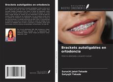 Brackets autoligables en ortodoncia kitap kapağı