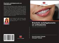 Brackets autoligaturants en orthodontie kitap kapağı