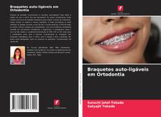 Capa do livro de Braquetes auto-ligáveis em Ortodontia 